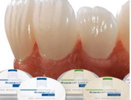 THỜI GIAN LÀM RĂNG SỨ TRONG BAO LÂU?